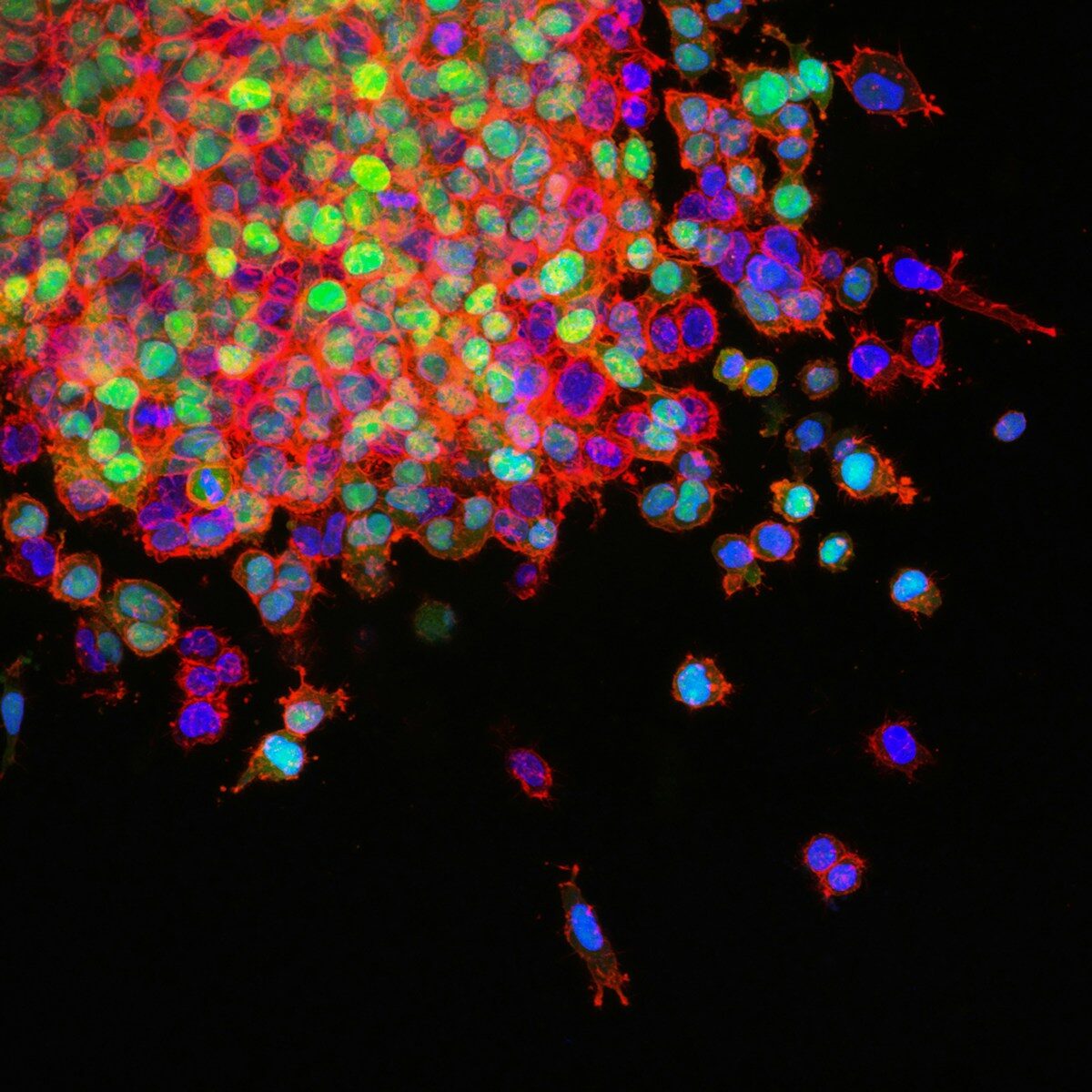 Vue cellules - PHOTO - National Cancer Institute - DR